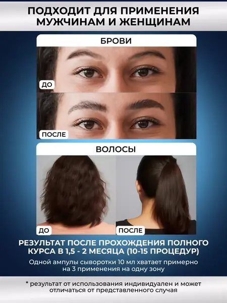 Мезороллер и сыворотка