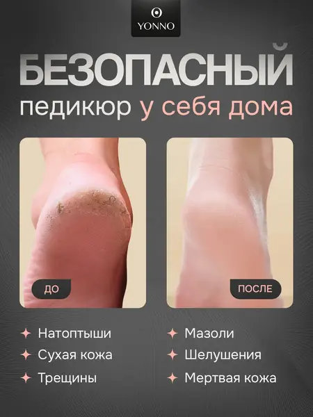 Электрическая пилка для ног